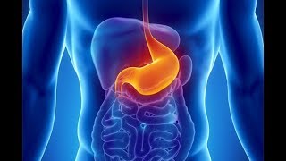 What is Dyspepsia What causes Dyspepsia Symptoms and Treatment of Indigestion [upl. by Attennaj]