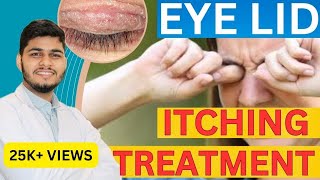 Eye Itching Causes Treatment Home remedies  Itching under Eye Skin [upl. by Anide]