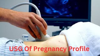 USG of Pregnancy Profile Bangla Lecture [upl. by Lucchesi]