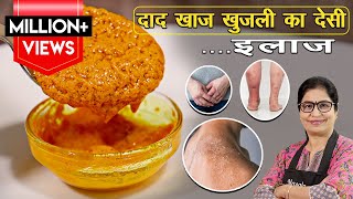 Herpes Infection Of Skin  हर्पीज़ के कारण लक्षण इलाज  Herpes Symptoms Causes Treatment  Hindi [upl. by Hen]