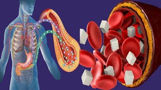 Hypoglycemia Without Diabetes Causes And Symptoms [upl. by Aseena]