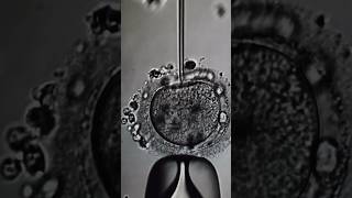 Fertilización in vitro bajo el microscopio 🔬 inyección espermática FIV [upl. by Llenod722]