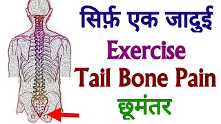 TAILBONE PAIN RELIEF  coccydynia   best exercise for instant tailbone pain relief  in hindi [upl. by Narhem]