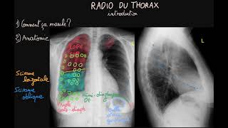 Radio du thorax  Introduction  Partie 1  Docteur Synapse [upl. by Taryn]