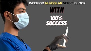 Inferior alveolar nerve block in every case [upl. by Eaves]