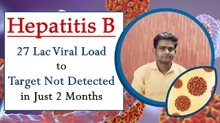 Hepatitis B Journey  27 Lac Viral Load to Target Not Detected in Just 2 Months [upl. by Browning]