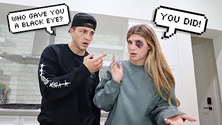 My Husband Gave Me a Black Eye Prank Cute Reaction [upl. by Ahsieni663]