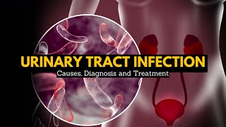 Urinary Tract Infection Causes Signs and Symptoms Diagnosis and Treatment [upl. by Suiramad]