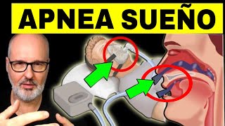 APNEA del SUEÑO Ronquidos y Somnolencia Causas Síntomas y Tratamiento [upl. by Atel]