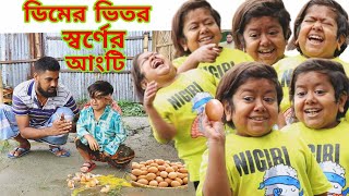 ডিমের ভিতর স্বর্ণের আংটি।ছোট দিপু 2023 সালের প্রথম ভিডিও।Chotu Dipu Comedy 2023।New Funny Video 2023 [upl. by Neetsirk]