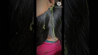 diyhairserumhomeremedy goodworking stronghairgrowth longhair shortvideo myyoutubechannel [upl. by Karly961]