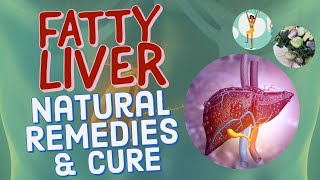 Fatty Liver Natural Remedies and Cures  By Dr Willie Ong Internist and Cardiologist [upl. by Snahc746]