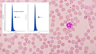 Heparin Induced Thrombocytopenia HIT and the Role of Serotonin Release Assay SRA [upl. by Vale464]