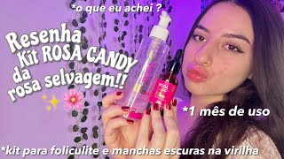 RESENHA DO KIT ROSA CANDY 🌸 para manchas escuras e foliculite na virilha [upl. by Bak]