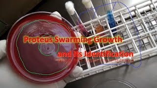 Proteus swarming growth on blood agar and its identification [upl. by Alyahc303]