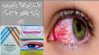 Conjunctivitis Infection Of Eyes  Epidemic In Pakistan Red eyes conjunctivitis [upl. by Hanshaw896]