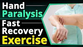 Hand Paralysis Fast Recovery Exercises  After Paralysis Hand Exercises  Dr Pragti Gupta [upl. by Rakso780]