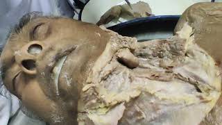 Dissection video by Dr Arnab sir Malda medical college [upl. by Lynette]