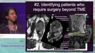 MRI in rectal cancer staging is mandatory [upl. by Laden113]