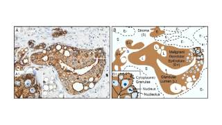 XMRV a New Human Retrovirus Lecture 25 [upl. by Arriek]