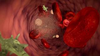 What is blood cancer [upl. by Eras]