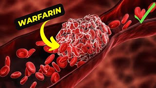 The Ultimate Guide to Understanding Warfarin Its Benefits and side effects [upl. by Sirahc]