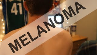 Melanoma Awareness [upl. by Arol]