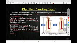 lec 5 endodontics root canal working length determination مرحلة رابعة طب أسنان [upl. by Livingston272]