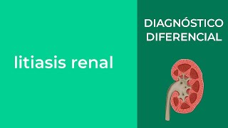 Diagnóstico diferencial de la litiasis renal [upl. by Meenen]