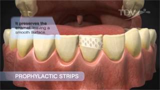 Prophylactic Strips TDV  Tartar Removal [upl. by Esau]