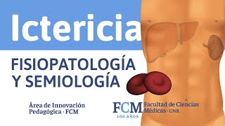 Ictericia  Fisiopatología y Semiología [upl. by Ikkir]