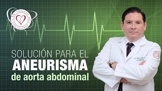 Solución para el Aneurisma de Aorta Abdominal [upl. by Felipe673]