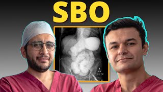 Ep 16 Mastering Bowel Obstruction Management Essential Tips for Surgeons [upl. by Aubreir]