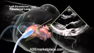 How to do a Basic Transthoracic Echocardiogram Transducer Position and Anatomy [upl. by Platas480]