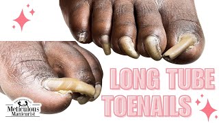 Trim Long Toenails Tutorial nails satisfying [upl. by Ive]