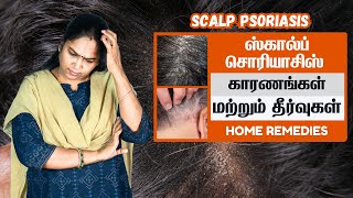 Scalp Psoriasis Causes and Remedies  ஸ்கால்ப் சொரியாசிஸ்  காரணங்கள் மற்றும் தீர்வுகள் [upl. by Elleynad]