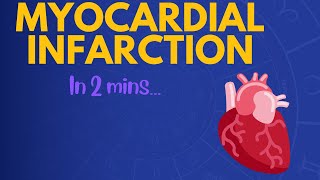 Myocardial Infarction in 2 mins [upl. by Eylrac926]