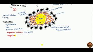 Tuberculosis for USMLE Step 1 and USMLE Step 2 [upl. by Clougher]