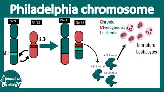 Philadelphia chromosome  Chromosome 9 to 22 translocation  BCRABL translocation CML pathology [upl. by Gaige]