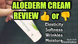 Aloederm cream review [upl. by Oeramed]