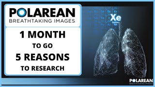 Polarean Imaging 1 Month to go 5 Reasons to Research [upl. by Galina]