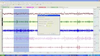 Fast Fourier Transformation [upl. by Stromberg]