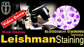 LEISHMAN STAINING  Blood Smear Staining Technique  Microbiology  Vivek Srinivas  Bacteriology [upl. by Cobby50]