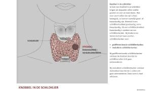 Nodus een knobbel in de schildklier [upl. by Truscott]