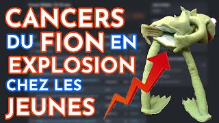 Les CANCERS du COLON en EXPLOSION chez les JEUNES [upl. by Randell66]