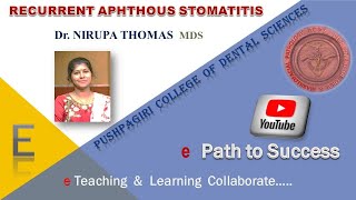 RECURRENT APHTHOUS STOMATITIS [upl. by Columbyne]