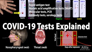 Understanding Different COVID19 Tests Animation [upl. by Bacchus966]