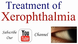 Treatment of Xerophthalmia [upl. by Allesig477]