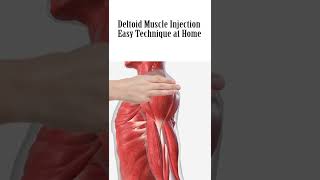 how to give deltoid muscle Injection [upl. by Hachman496]