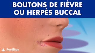 BOUTON DE FIÈVRE  Questce que lherpès buccal et comment se propagetil © [upl. by Kimberley]